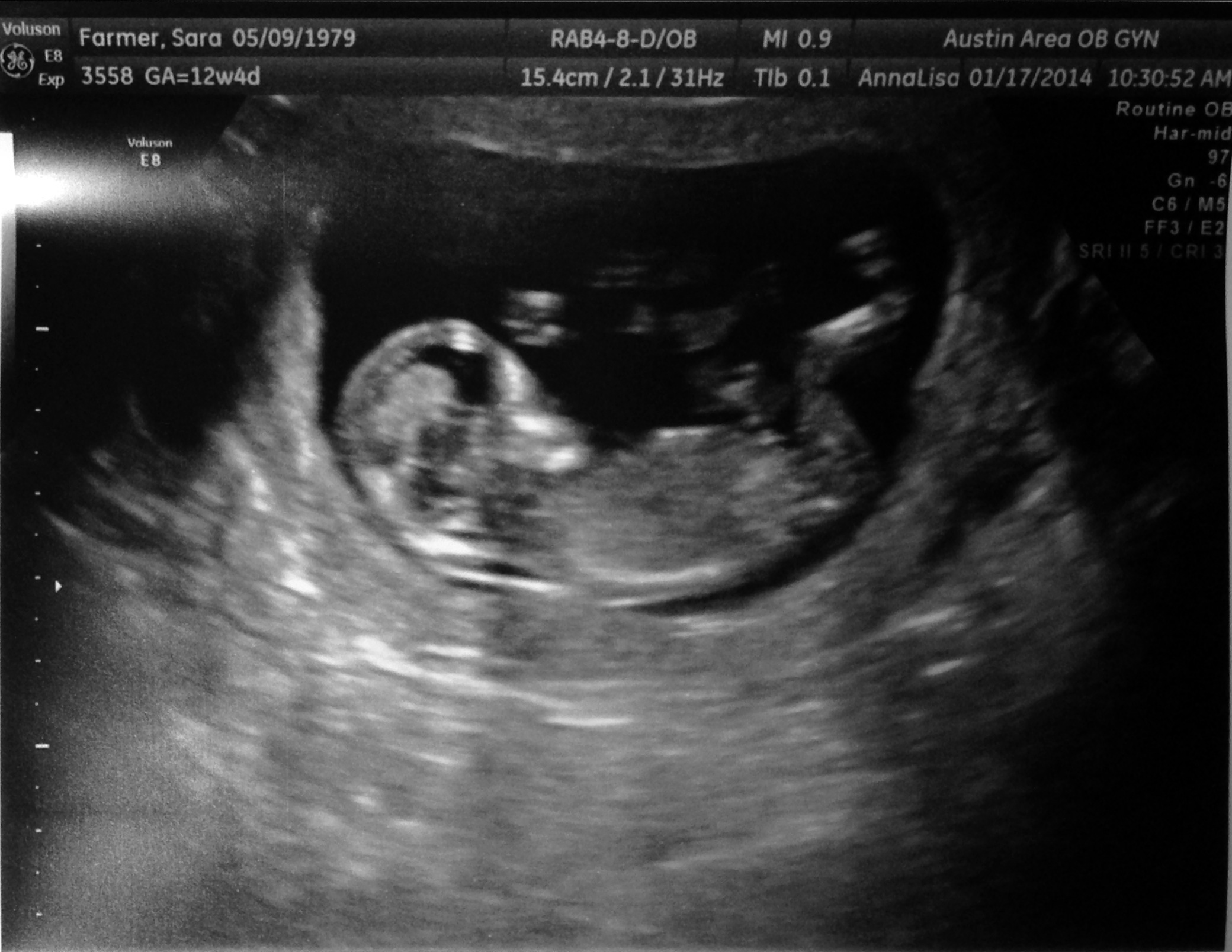 The 12-week Appointment and Ultrasound | Kittymomma's Adventures